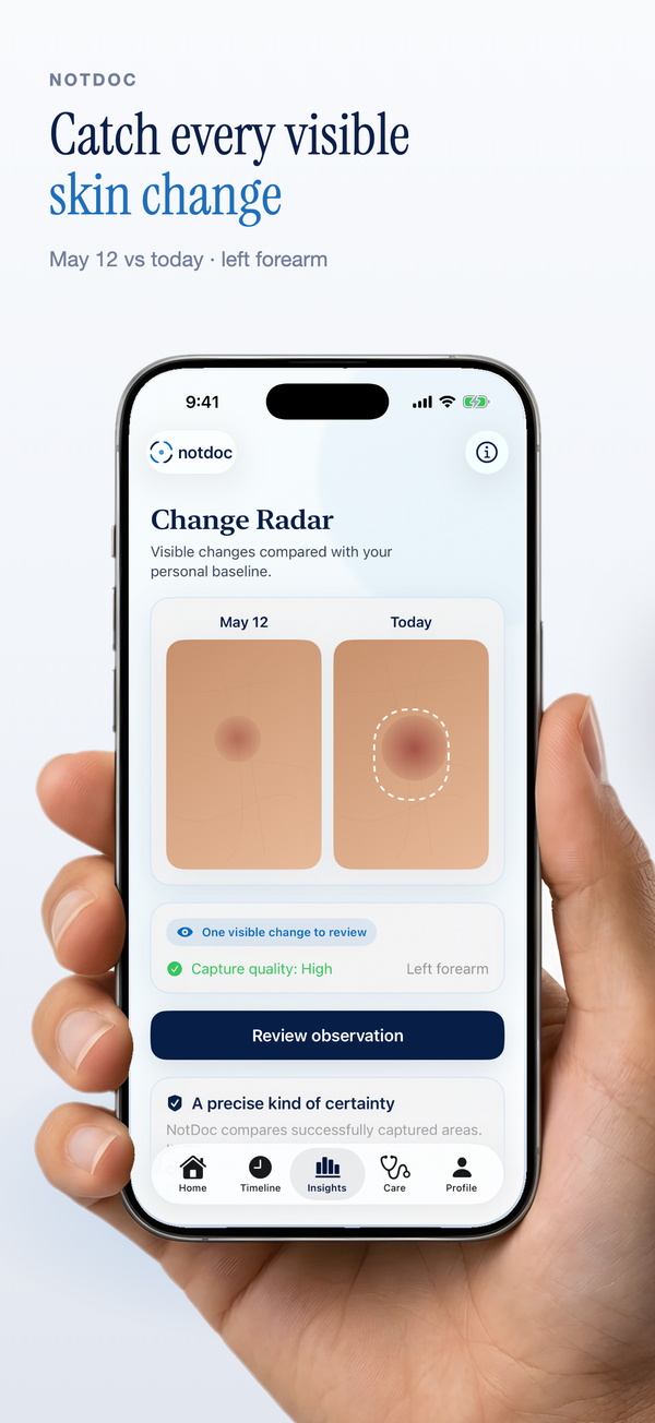 App Store slide — Catch every visible skin change